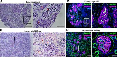 Assessing kidney development and disease using kidney organoids and CRISPR engineering